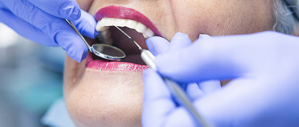 Best Emergency Treatment for Dental Infections or Abscesses in Clayton, DE